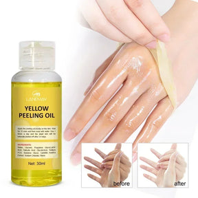 Yellow Peeling Oil Exfoliating Bleaching Dark Skin Spots Knee Finger Remove Dead Skin Melanin Whitening Brighten Body Skin Care