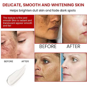 eelhoe Niacinamide Melasma Brightening Cream Reduce Melanin Lighten Dark Skin Chloasma Serum Fade Fine Lines Korean Care Product