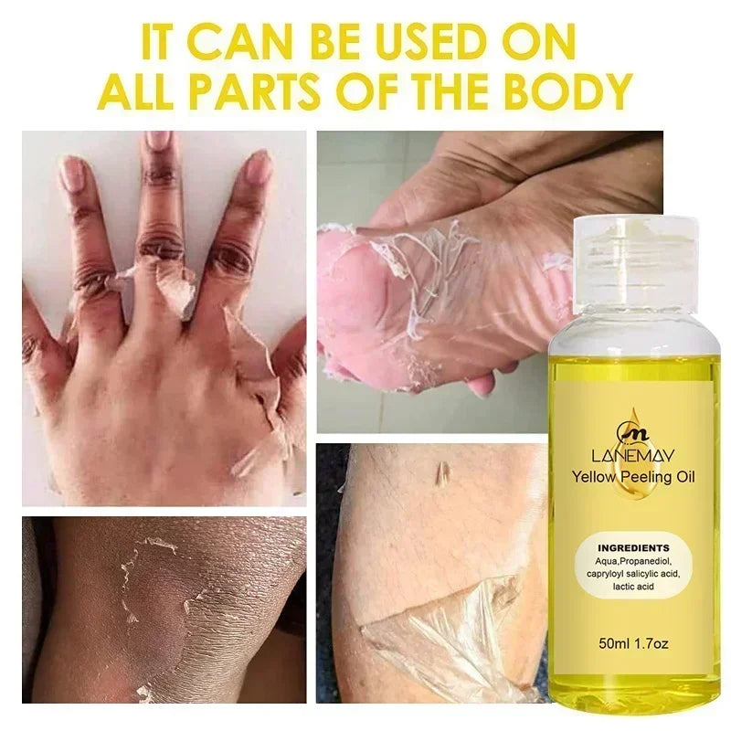 Yellow Peeling Oil Exfoliating Bleaching Dark Skin Spots Knee Finger Remove Dead Skin Melanin Whitening Brighten Body Skin Care