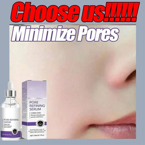 Eliminate All Large Pores Serum Facial Care Firming Rejuvenation Delicate Pore Repair Whitening Brightening Essence