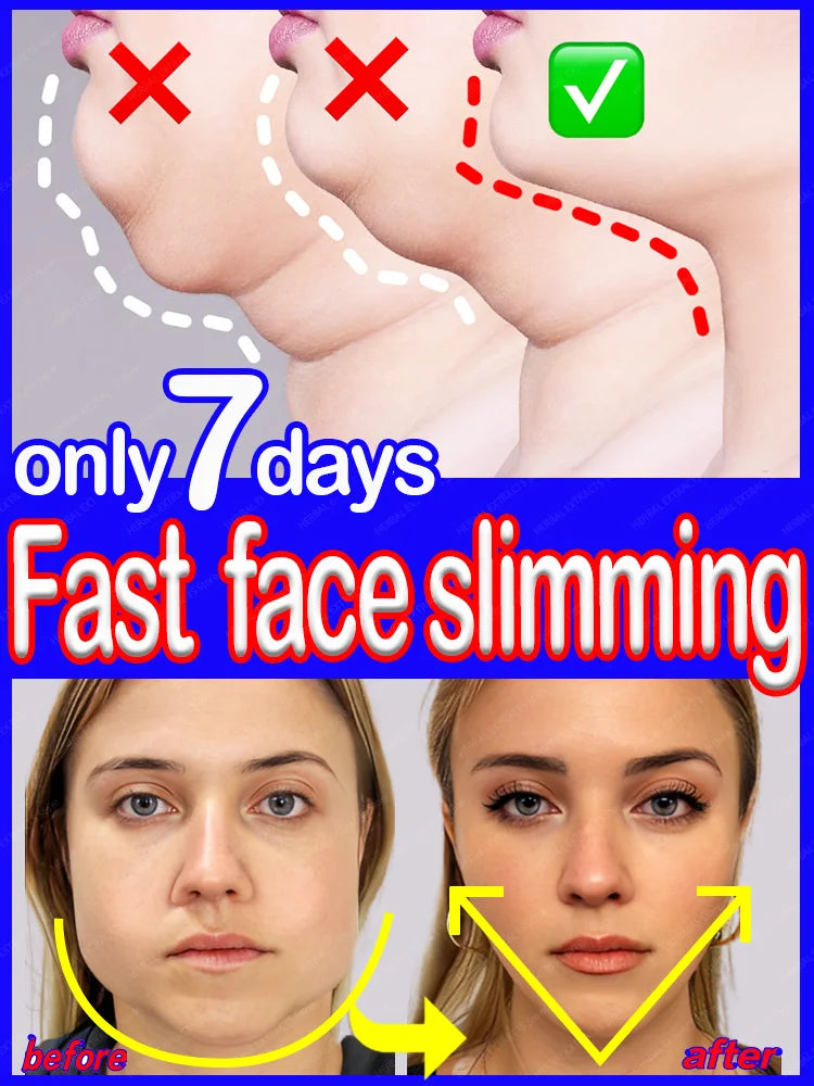 Double Chin V Shape Remove The face fat