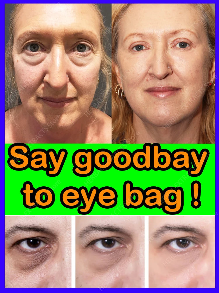 Eye Cream Dark Circles And Bag Removal For Anti Bags In The Eyes Under Contour Area