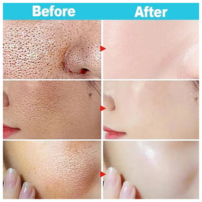 Salicylic Acid Pore Shrinking Cream Repairing Tightening Face Serum Moisturizing Oil Control Skin Care Korean Cosmetic 2024